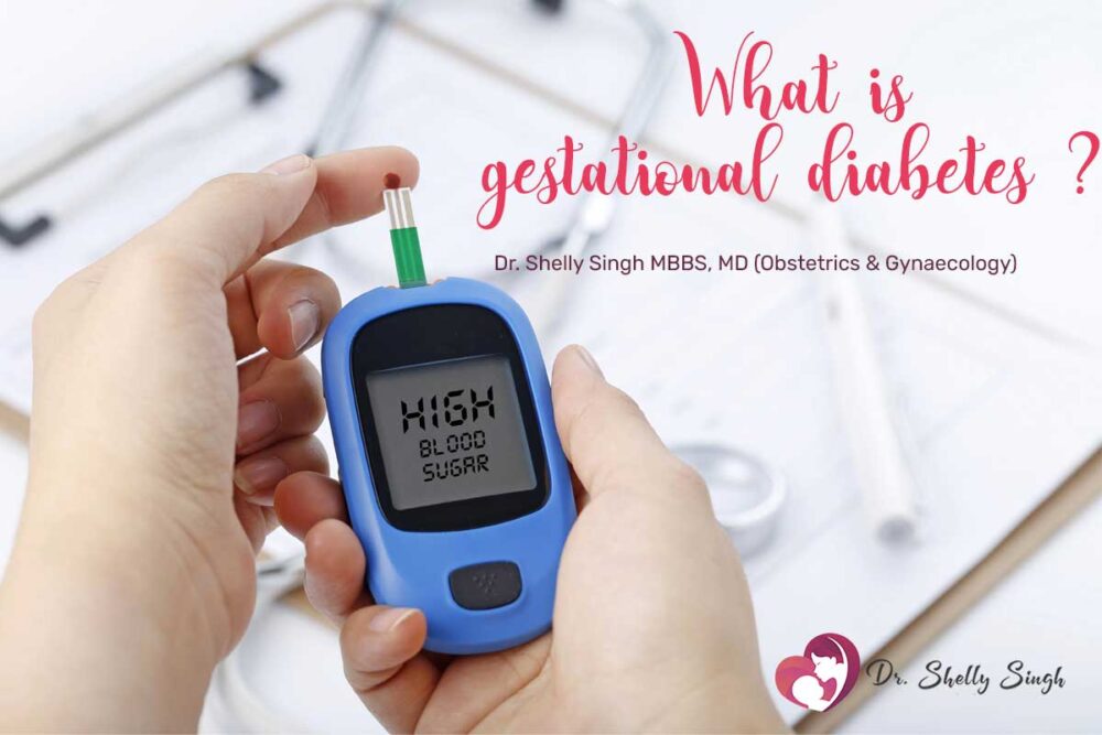 WHAT IS GESTATIONAL DIABETES?