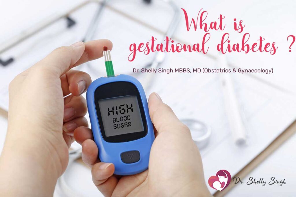 WHAT IS GESTATIONAL DIABETES?