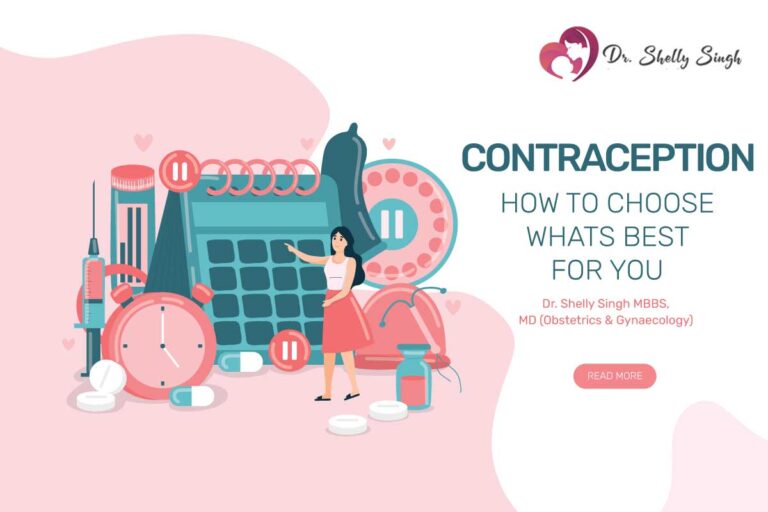 CONTRACEPTION – HOW TO CHOOSE WHATS BEST FOR YOU