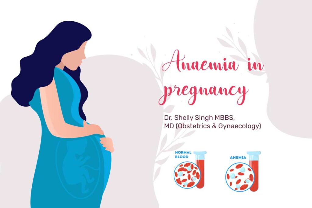 Anaemia in Pregnancy