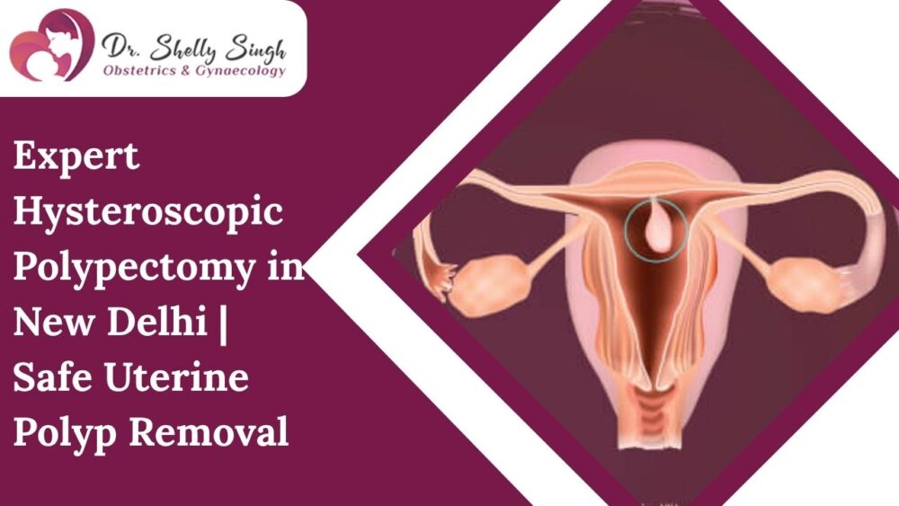Expert hysteroscopic polypectomy in new Delhi