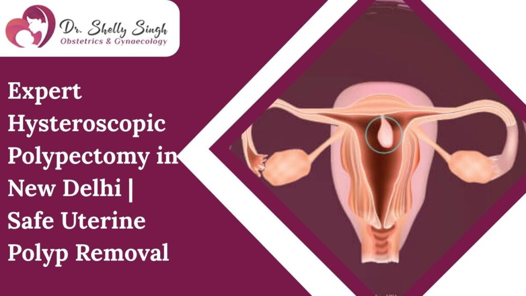 Expert Hysteroscopic Polypectomy in New Delhi: A Simple Solution for Complex Period and Fertility Problems