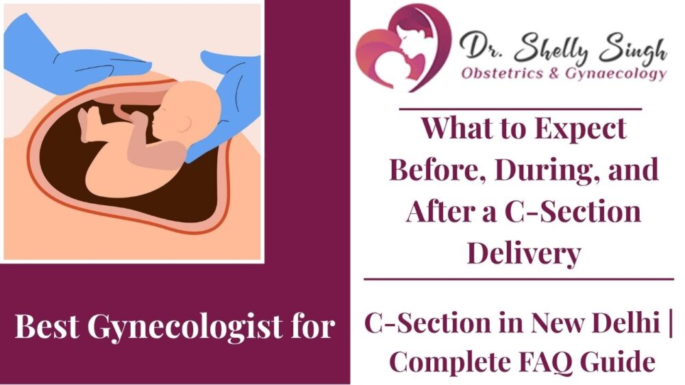 C-section in New Delhi