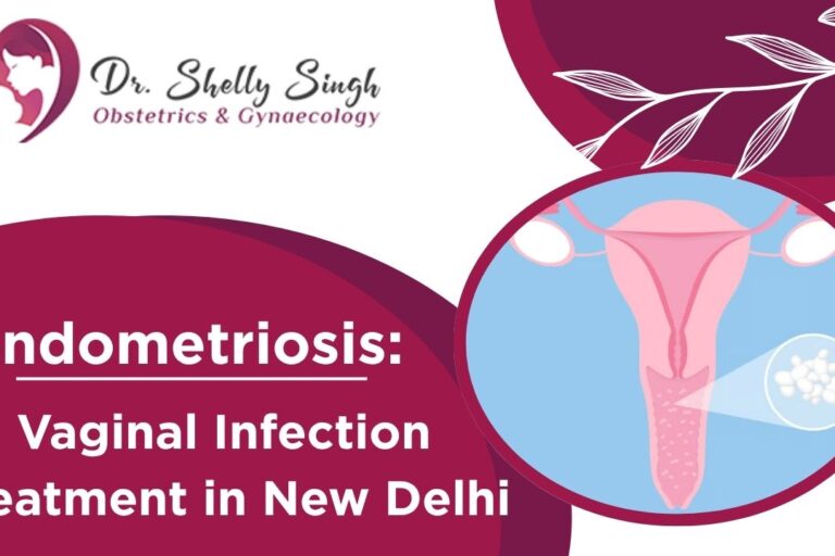 Understanding Endometriosis – Why Timely Diagnosis Is Crucial