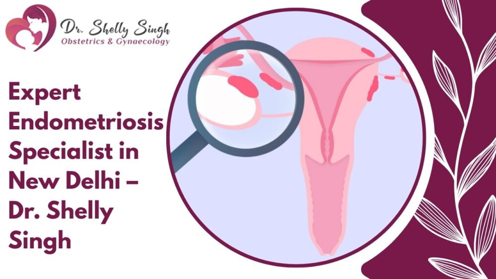 expert endometriosis specialist in New Delhi
