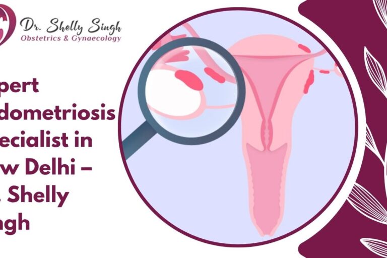 Painful Periods or Something More? When to Get Checked for Endometriosis